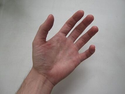 You can enlarge your penis with your hands using the Jelqing technique